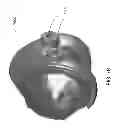 Fig. 115 - PATIENT-ADAPTED AND IMPROVED ARTICULAR IMPLANTS, DESIGNS AND RELATED GUIDE TOOLS