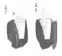 Fig. 124 - PATIENT-ADAPTED AND IMPROVED ARTICULAR IMPLANTS, DESIGNS AND RELATED GUIDE TOOLS