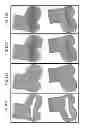 Fig. 129 - PATIENT-ADAPTED AND IMPROVED ARTICULAR IMPLANTS, DESIGNS AND RELATED GUIDE TOOLS