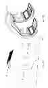 Fig. 136 - PATIENT-ADAPTED AND IMPROVED ARTICULAR IMPLANTS, DESIGNS AND RELATED GUIDE TOOLS