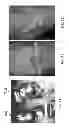 Fig. 14 - PATIENT-ADAPTED AND IMPROVED ARTICULAR IMPLANTS, DESIGNS AND RELATED GUIDE TOOLS