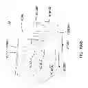 Fig. 145 - PATIENT-ADAPTED AND IMPROVED ARTICULAR IMPLANTS, DESIGNS AND RELATED GUIDE TOOLS