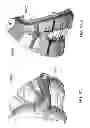 Fig. 148 - PATIENT-ADAPTED AND IMPROVED ARTICULAR IMPLANTS, DESIGNS AND RELATED GUIDE TOOLS
