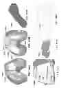 Fig. 151 - PATIENT-ADAPTED AND IMPROVED ARTICULAR IMPLANTS, DESIGNS AND RELATED GUIDE TOOLS