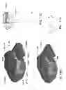 Fig. 153 - PATIENT-ADAPTED AND IMPROVED ARTICULAR IMPLANTS, DESIGNS AND RELATED GUIDE TOOLS