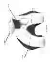 Fig. 170 - PATIENT-ADAPTED AND IMPROVED ARTICULAR IMPLANTS, DESIGNS AND RELATED GUIDE TOOLS