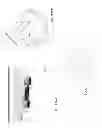 Fig. 176 - PATIENT-ADAPTED AND IMPROVED ARTICULAR IMPLANTS, DESIGNS AND RELATED GUIDE TOOLS