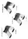 Fig. 191 - PATIENT-ADAPTED AND IMPROVED ARTICULAR IMPLANTS, DESIGNS AND RELATED GUIDE TOOLS