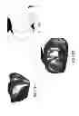 Fig. 192 - PATIENT-ADAPTED AND IMPROVED ARTICULAR IMPLANTS, DESIGNS AND RELATED GUIDE TOOLS
