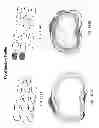 Fig. 205 - PATIENT-ADAPTED AND IMPROVED ARTICULAR IMPLANTS, DESIGNS AND RELATED GUIDE TOOLS