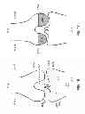 Fig. 23 - PATIENT-ADAPTED AND IMPROVED ARTICULAR IMPLANTS, DESIGNS AND RELATED GUIDE TOOLS