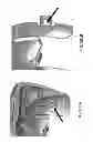 Fig. 233 - PATIENT-ADAPTED AND IMPROVED ARTICULAR IMPLANTS, DESIGNS AND RELATED GUIDE TOOLS