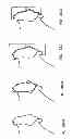 Fig. 239 - PATIENT-ADAPTED AND IMPROVED ARTICULAR IMPLANTS, DESIGNS AND RELATED GUIDE TOOLS
