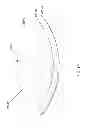 Fig. 258 - PATIENT-ADAPTED AND IMPROVED ARTICULAR IMPLANTS, DESIGNS AND RELATED GUIDE TOOLS