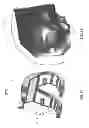 Fig. 26 - PATIENT-ADAPTED AND IMPROVED ARTICULAR IMPLANTS, DESIGNS AND RELATED GUIDE TOOLS