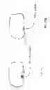 Fig. 27 - PATIENT-ADAPTED AND IMPROVED ARTICULAR IMPLANTS, DESIGNS AND RELATED GUIDE TOOLS