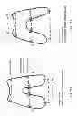 Fig. 34 - PATIENT-ADAPTED AND IMPROVED ARTICULAR IMPLANTS, DESIGNS AND RELATED GUIDE TOOLS