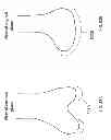 Fig. 43 - PATIENT-ADAPTED AND IMPROVED ARTICULAR IMPLANTS, DESIGNS AND RELATED GUIDE TOOLS