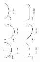 Fig. 44 - PATIENT-ADAPTED AND IMPROVED ARTICULAR IMPLANTS, DESIGNS AND RELATED GUIDE TOOLS
