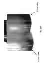 Fig. 47 - PATIENT-ADAPTED AND IMPROVED ARTICULAR IMPLANTS, DESIGNS AND RELATED GUIDE TOOLS