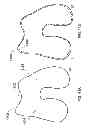 Fig. 53 - PATIENT-ADAPTED AND IMPROVED ARTICULAR IMPLANTS, DESIGNS AND RELATED GUIDE TOOLS