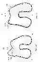 Fig. 55 - PATIENT-ADAPTED AND IMPROVED ARTICULAR IMPLANTS, DESIGNS AND RELATED GUIDE TOOLS