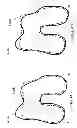 Fig. 56 - PATIENT-ADAPTED AND IMPROVED ARTICULAR IMPLANTS, DESIGNS AND RELATED GUIDE TOOLS