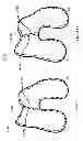 Fig. 57 - PATIENT-ADAPTED AND IMPROVED ARTICULAR IMPLANTS, DESIGNS AND RELATED GUIDE TOOLS