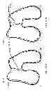 Fig. 59 - PATIENT-ADAPTED AND IMPROVED ARTICULAR IMPLANTS, DESIGNS AND RELATED GUIDE TOOLS