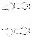 Fig. 60 - PATIENT-ADAPTED AND IMPROVED ARTICULAR IMPLANTS, DESIGNS AND RELATED GUIDE TOOLS