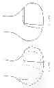 Fig. 74 - PATIENT-ADAPTED AND IMPROVED ARTICULAR IMPLANTS, DESIGNS AND RELATED GUIDE TOOLS