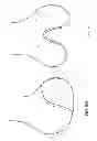 Fig. 76 - PATIENT-ADAPTED AND IMPROVED ARTICULAR IMPLANTS, DESIGNS AND RELATED GUIDE TOOLS