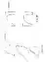 Fig. 79 - PATIENT-ADAPTED AND IMPROVED ARTICULAR IMPLANTS, DESIGNS AND RELATED GUIDE TOOLS