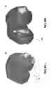 Fig. 82 - PATIENT-ADAPTED AND IMPROVED ARTICULAR IMPLANTS, DESIGNS AND RELATED GUIDE TOOLS
