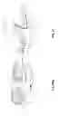 Fig. 91 - PATIENT-ADAPTED AND IMPROVED ARTICULAR IMPLANTS, DESIGNS AND RELATED GUIDE TOOLS