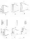 Fig. 97 - PATIENT-ADAPTED AND IMPROVED ARTICULAR IMPLANTS, DESIGNS AND RELATED GUIDE TOOLS