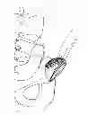 Fig. 06 - PROSTHESIS