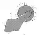 Fig. 01 - FEMORAL PROSTHESIS WITH AN OFFSET HEAD