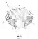 Fig. 06 - Negative-positive pressurizable implant