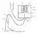 Fig. 01 - Vacuum assisted suspension system