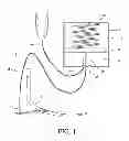 Fig. 02 - Vacuum assisted suspension system