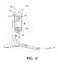 Fig. 07 - Vacuum assisted suspension system