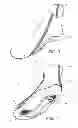 Fig. 04 - Article of footwear with detachable upper and lower designs