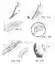 Fig. 06 - Article of footwear with detachable upper and lower designs