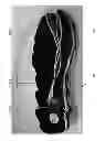Fig. 09 - Battery casing for illuminating footwear