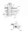 Fig. 04 - OPERATING ASSEMBLY FOR USE WITH AUTOMATIC SLIDING AND FOLDING DOORS