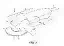 Fig. 02 - Device for making lacerations in a surface and method thereof