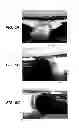 Fig. 07 - Surf wake system for a watercraft