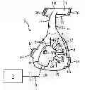 Fig. 01 - Exhaust gas assembly for a patient interface device