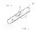 Fig. 02 - Pony tail wrap
